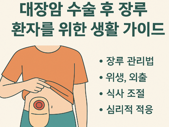 대장암 수술 후 장루 환자를 위한 생활 가이드