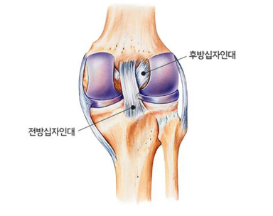 십자인대