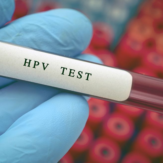 hpv 바이러스 예방접종