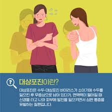 대상포진 초기증상