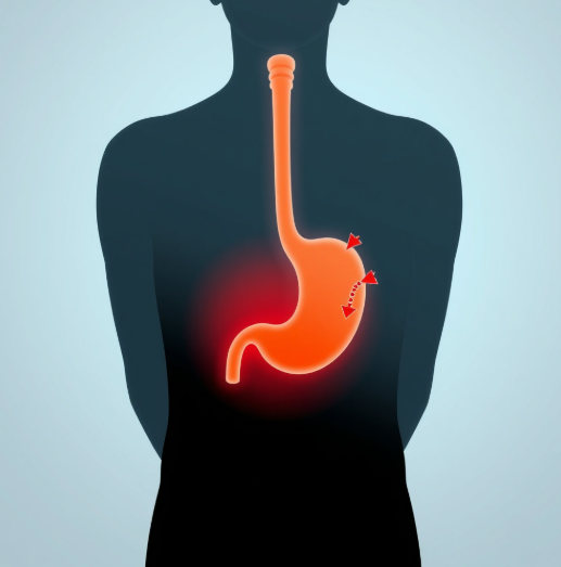 역류성식도염 초기증상 놓치기 쉬운 신호