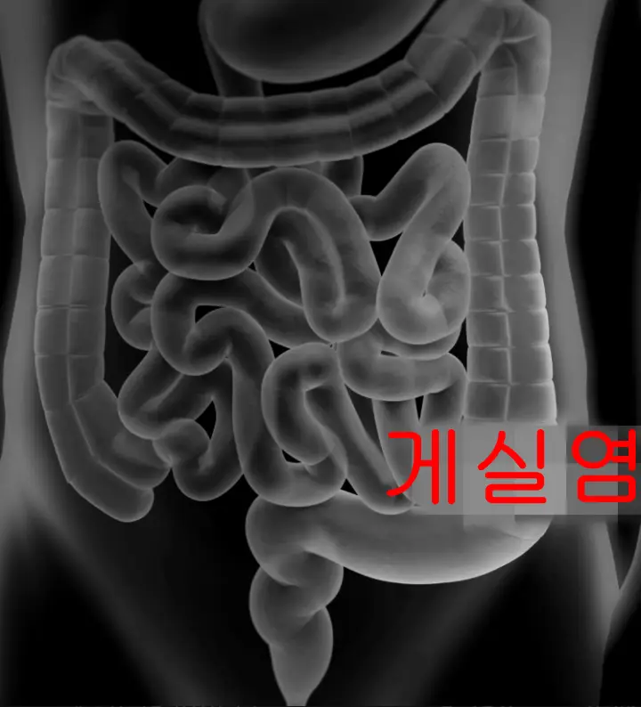 장기-사진-엑스레이