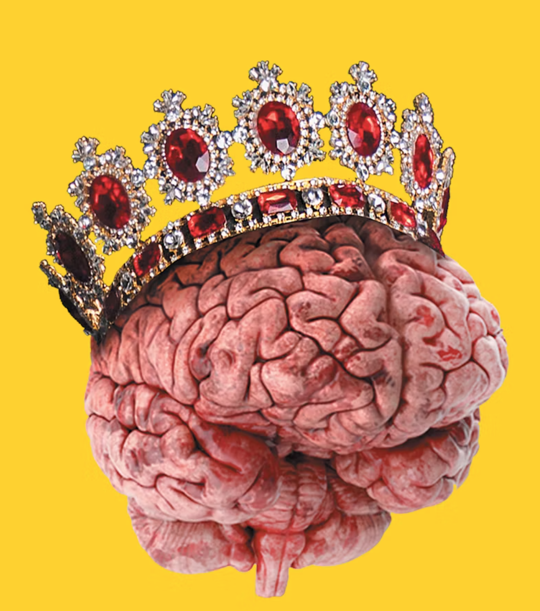 도파민 결핍증과 과잉분비증의 특징