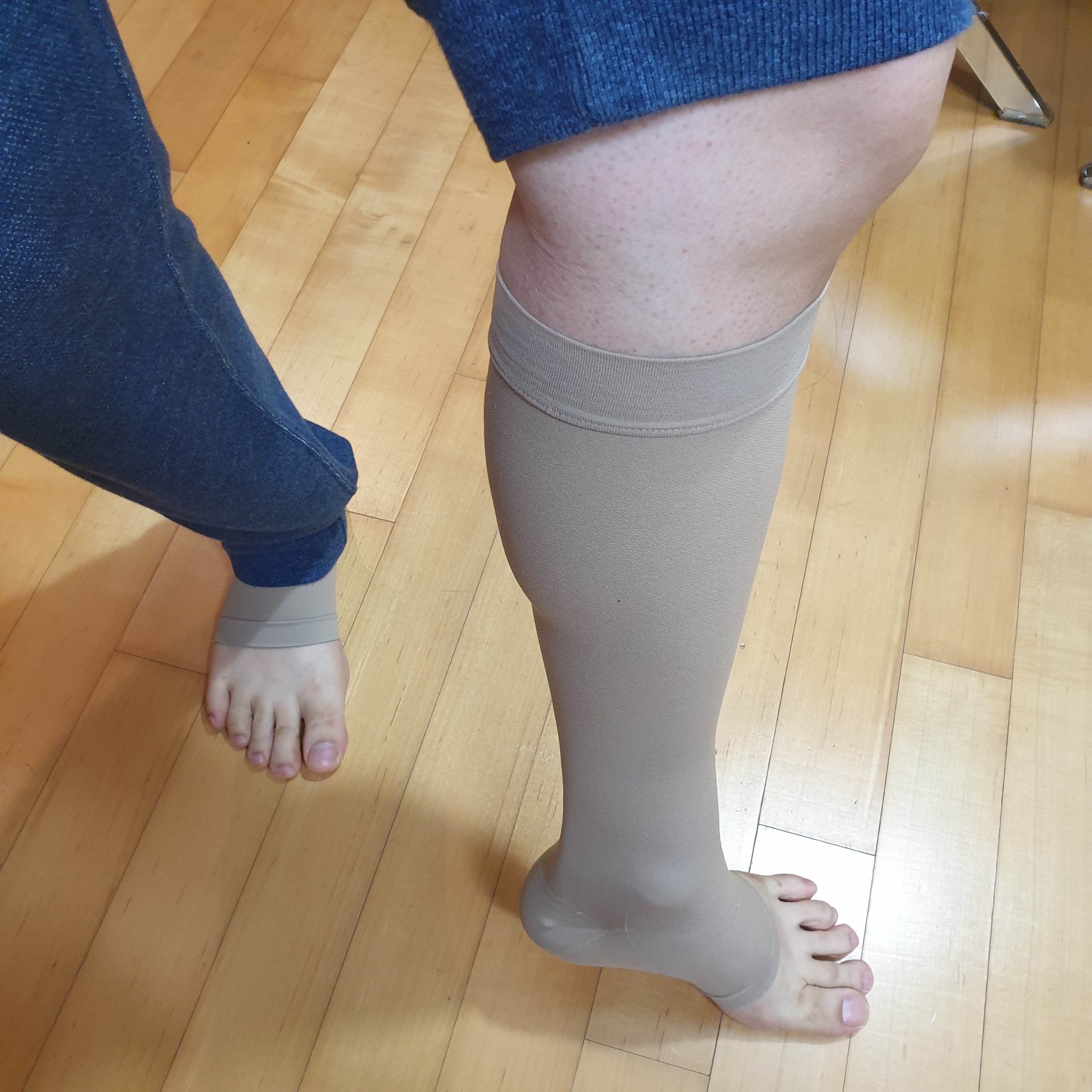 하지정맥류수술후기