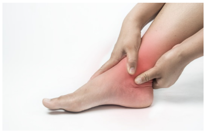 발목 염좌 통증