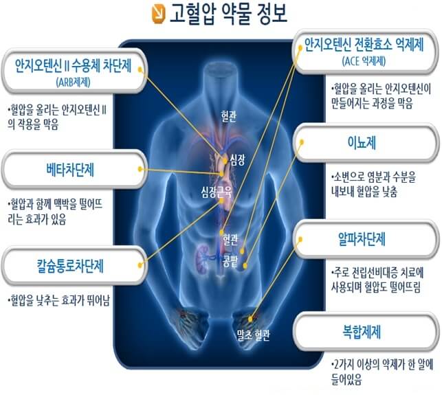 고혈압