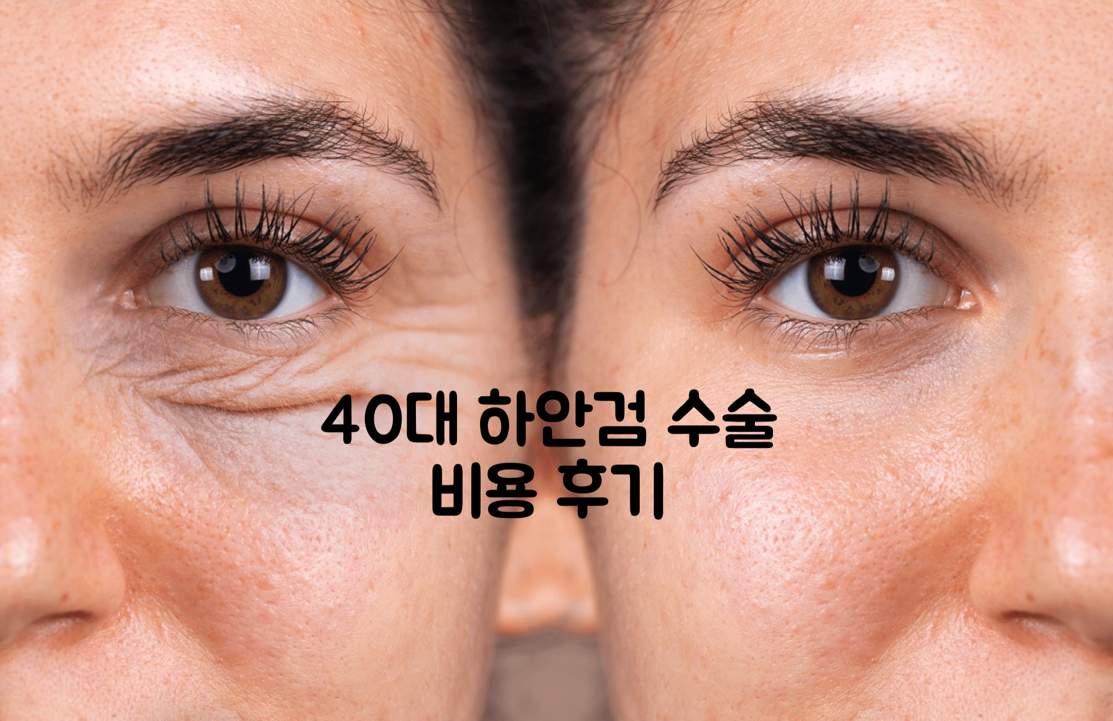 40대 하안검