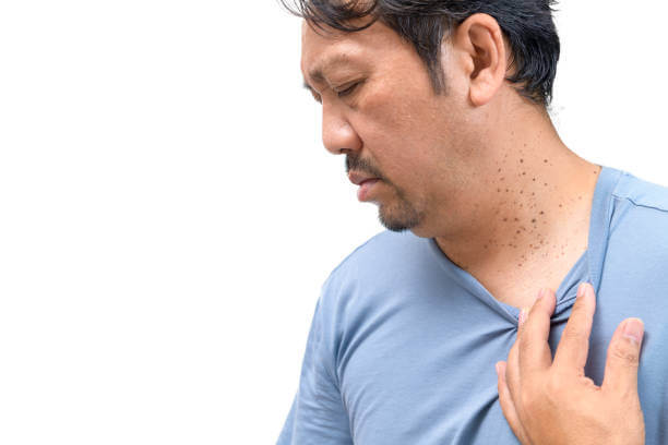 목에 쥐젖이 생겼다면? 레이저 제거 비용과 부작용!