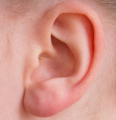 글의 이해를 돕기 위한 사진