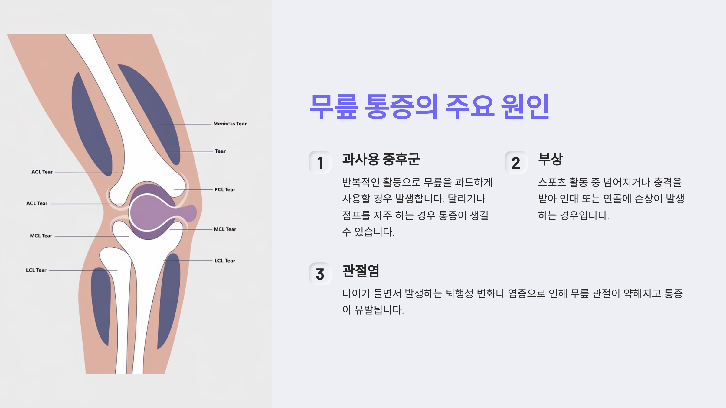 무릎 통증의 주요 원인