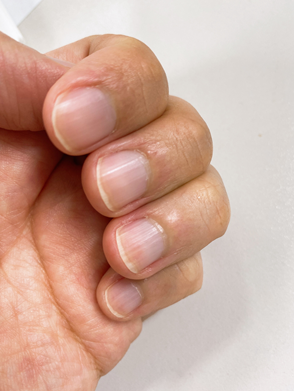 손톱을 확인 하는 모습