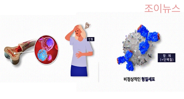 다발성 골수종의 증상, 고칼슘혈증, 형질세포 생성