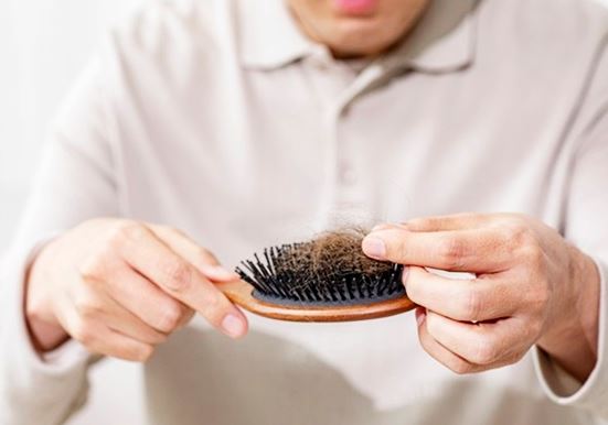 미녹시딜-정-효과