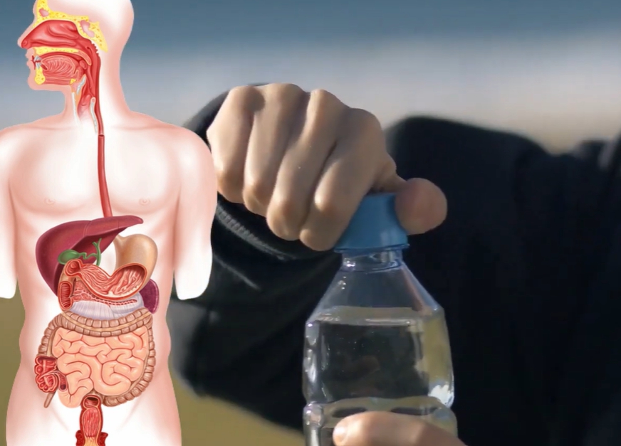 장누수증후군 증상