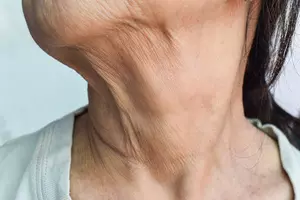 목주름 없애는법