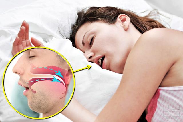 피곤해요 피로감 만성피로 원인 수면무호흡증