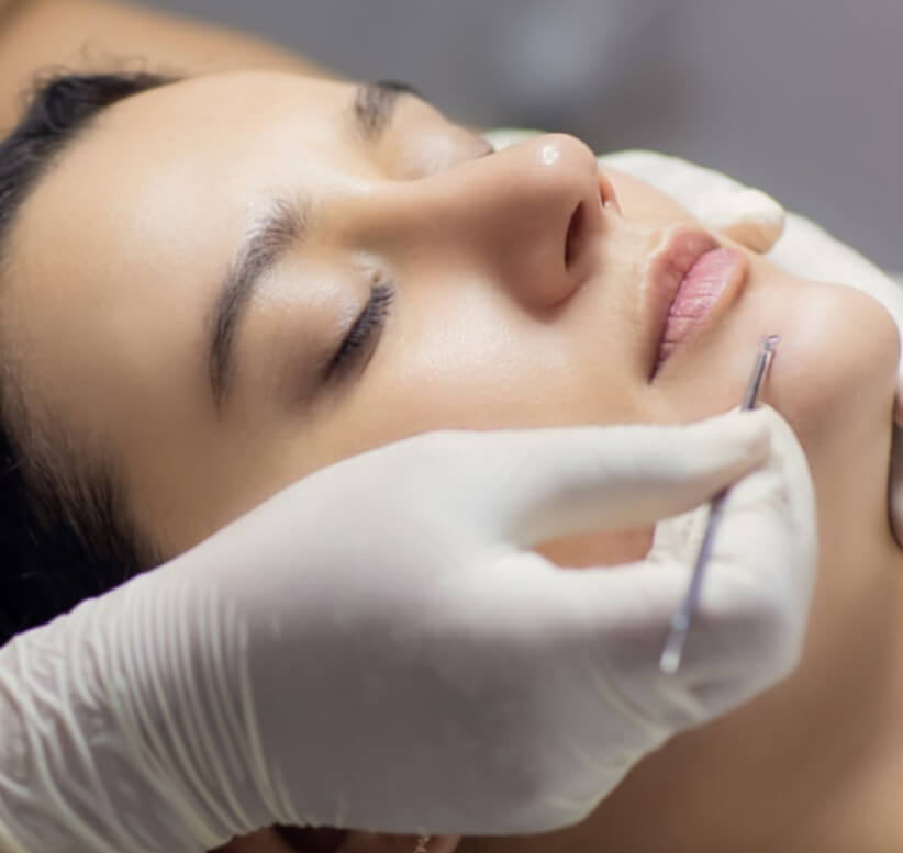 모고 피지 제거 모습