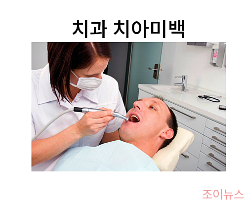 치과에서 받는 치아미백 모습, 셀프 치아미백과 어떤 차이가 있을까요?