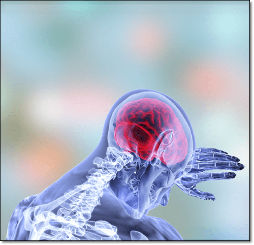 열감이 있는 뇌