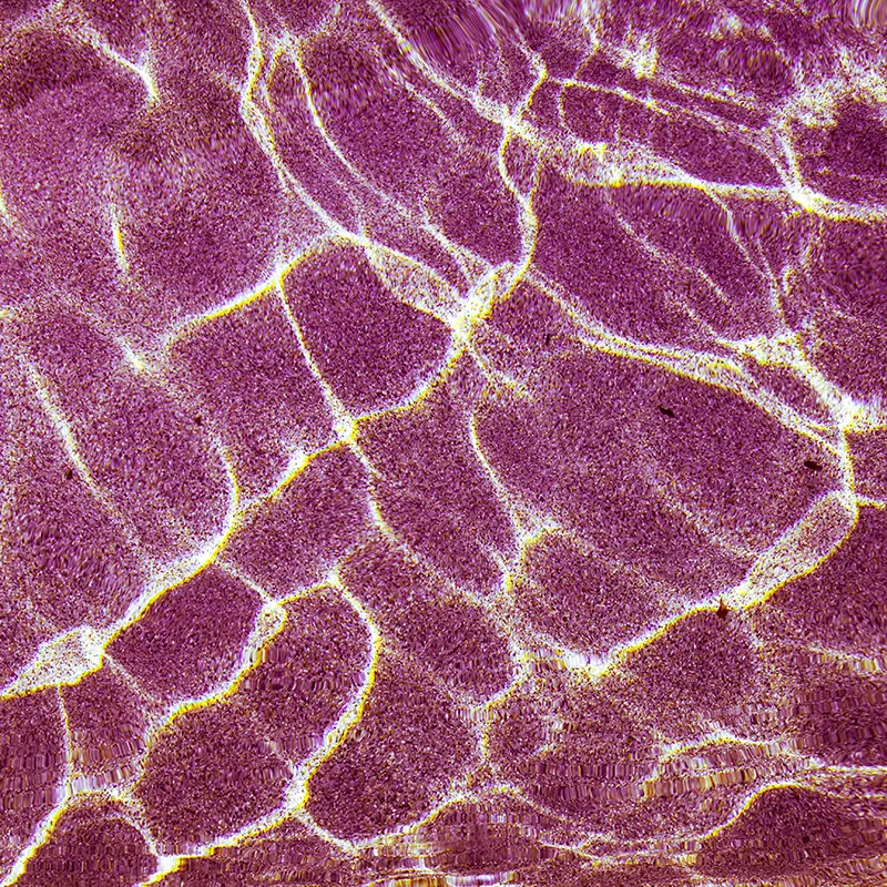 중년 여성 피부노화에 콜라겐 효과 있나요? 잡티까지 개선될까