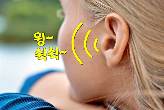 귀에서 윙소리가 나요 뇌진탕 초기증상, 귀에서 쉭쉭소리 뇌진탕 증상,건강 팁줌 매일꿀정보