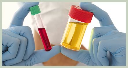 소변에 피가 섞여서 나오는 증상 혈뇨증상