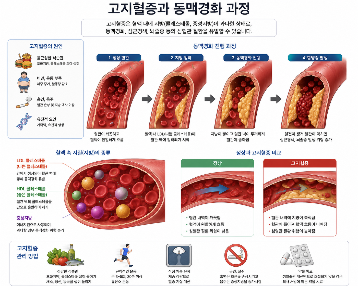 고지혈증과 동맥경화 과정 설명