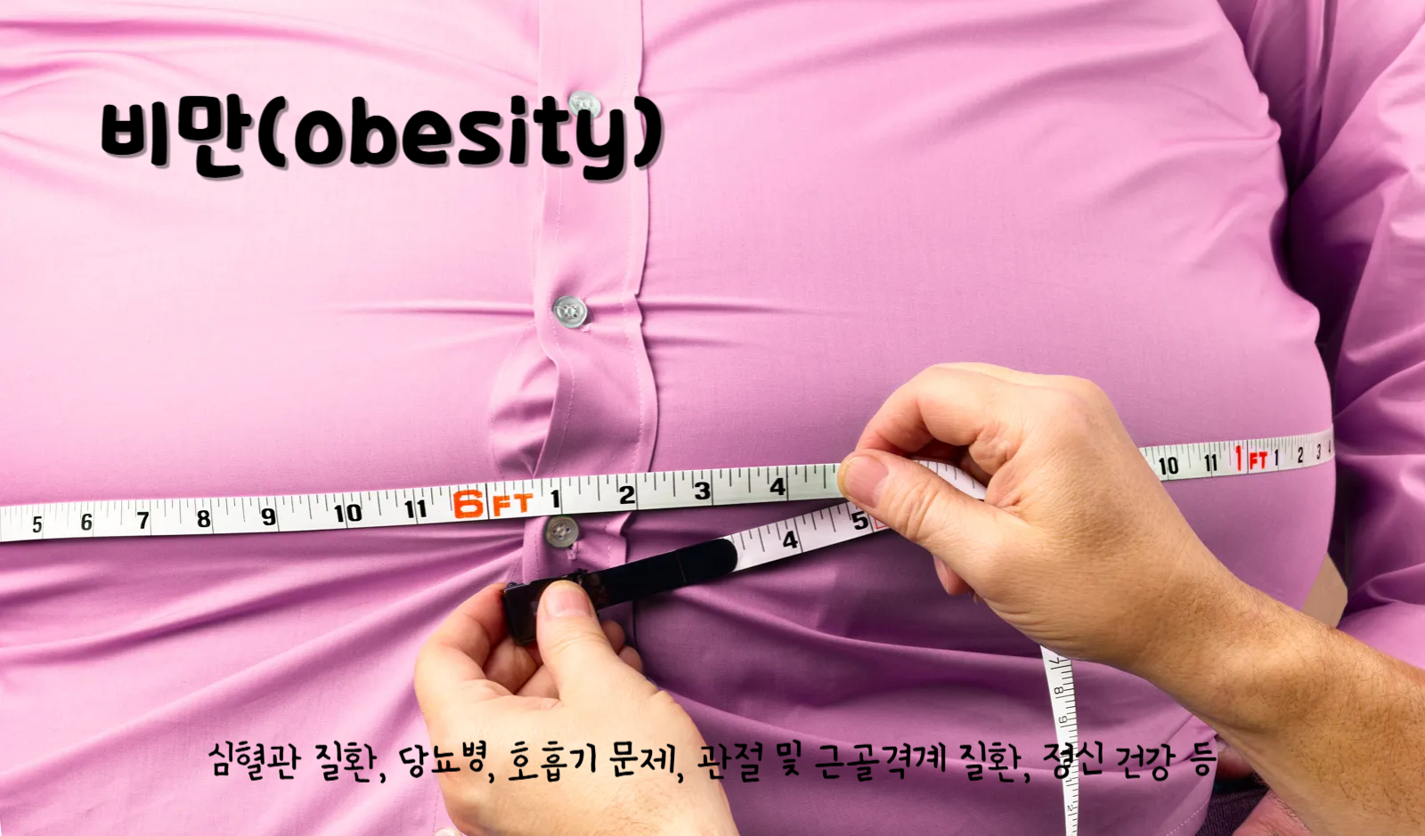비만(obesity)
비만이 건강에 미치는 영향 : 심혈관 질환, 당뇨병, 호흡기 문제, 관절 및 근골격계 질환, 정신 건강 등