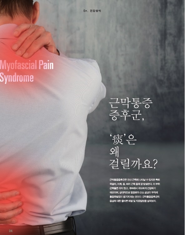 근막통증증후군 원인과 치료 방법
