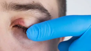 신장이 안좋으면 나타나는 증상 22