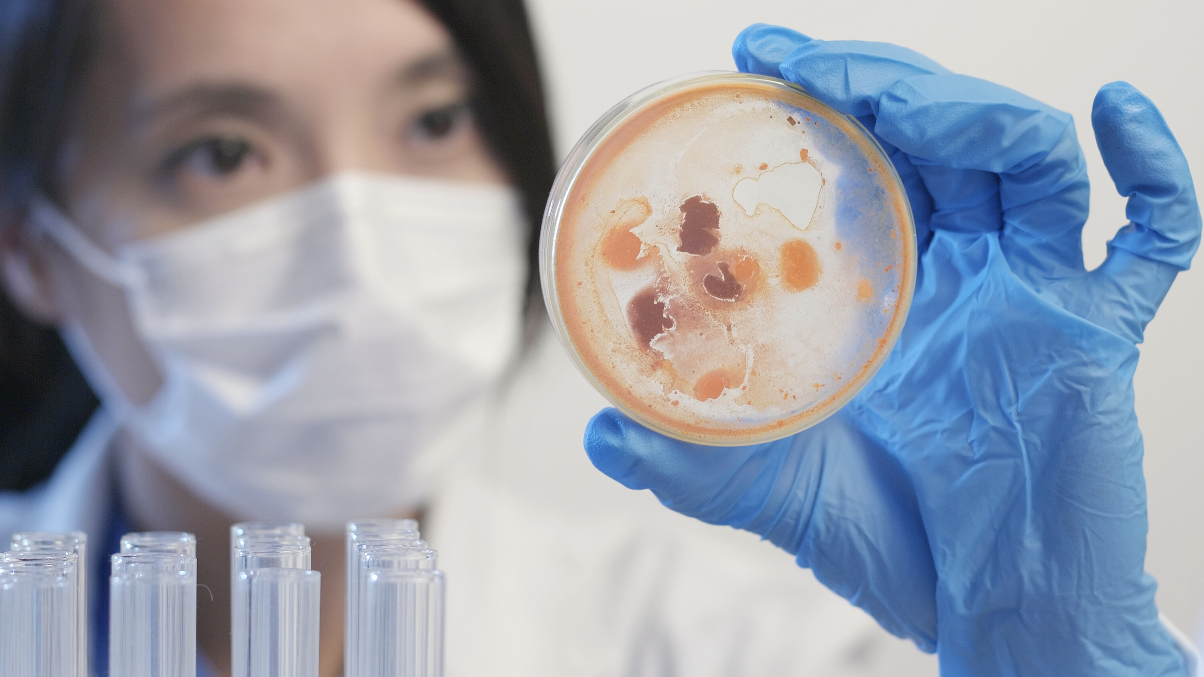 마이코플라즈마폐렴의 원인과 전파