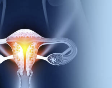 자궁근종 증상 수술후 회복기간 크기별 치료 등 총정리(24년 Ver)