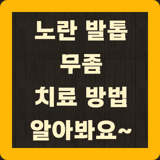 노란 발톱 무좀 치료 방법