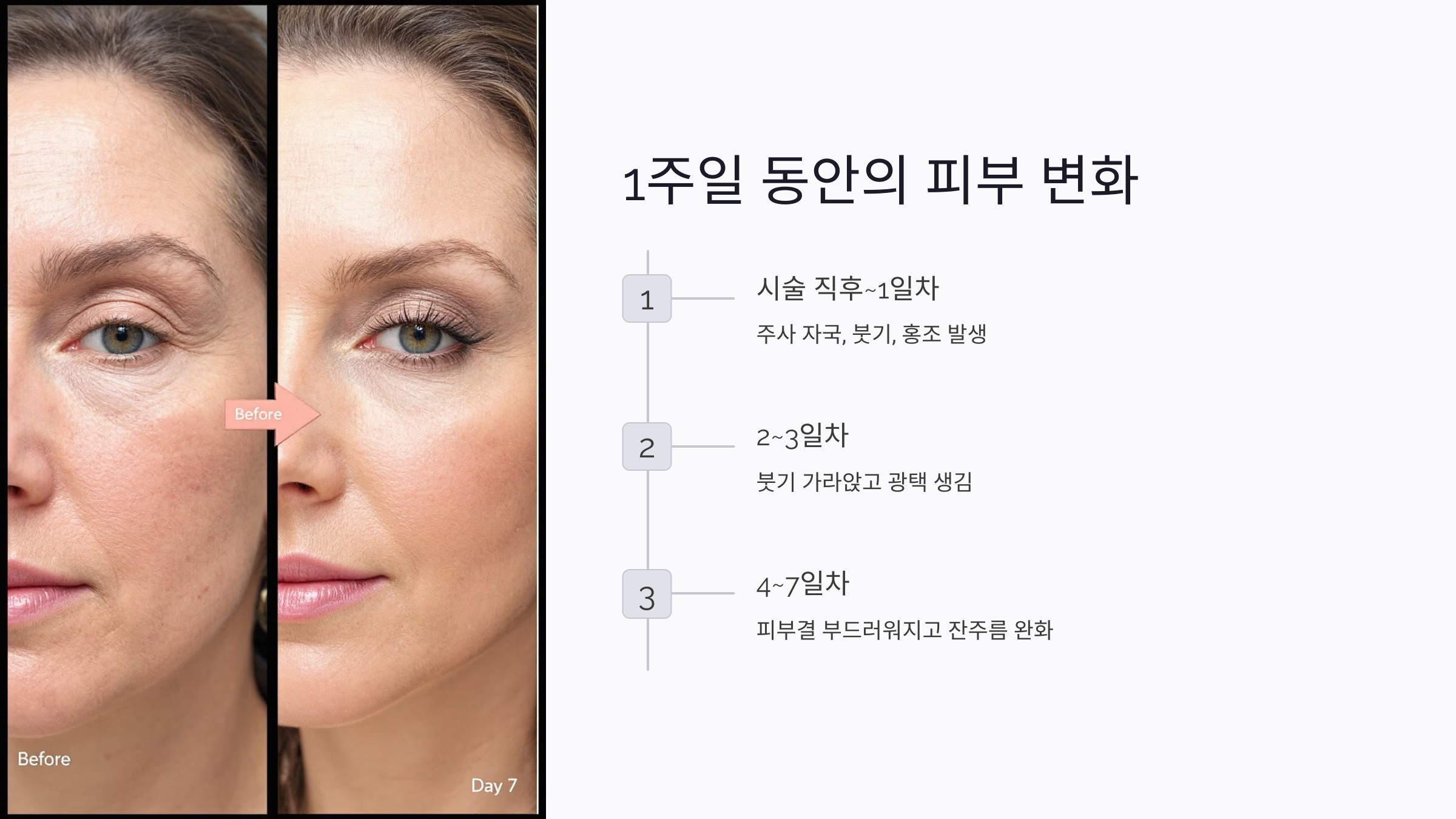 연어주사 시술 후 1주일 동안 피부는 어떻게 달라질까?