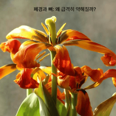 폐경기 여성 골다공증과 호르몬 치료 가이드 (2025 최신)