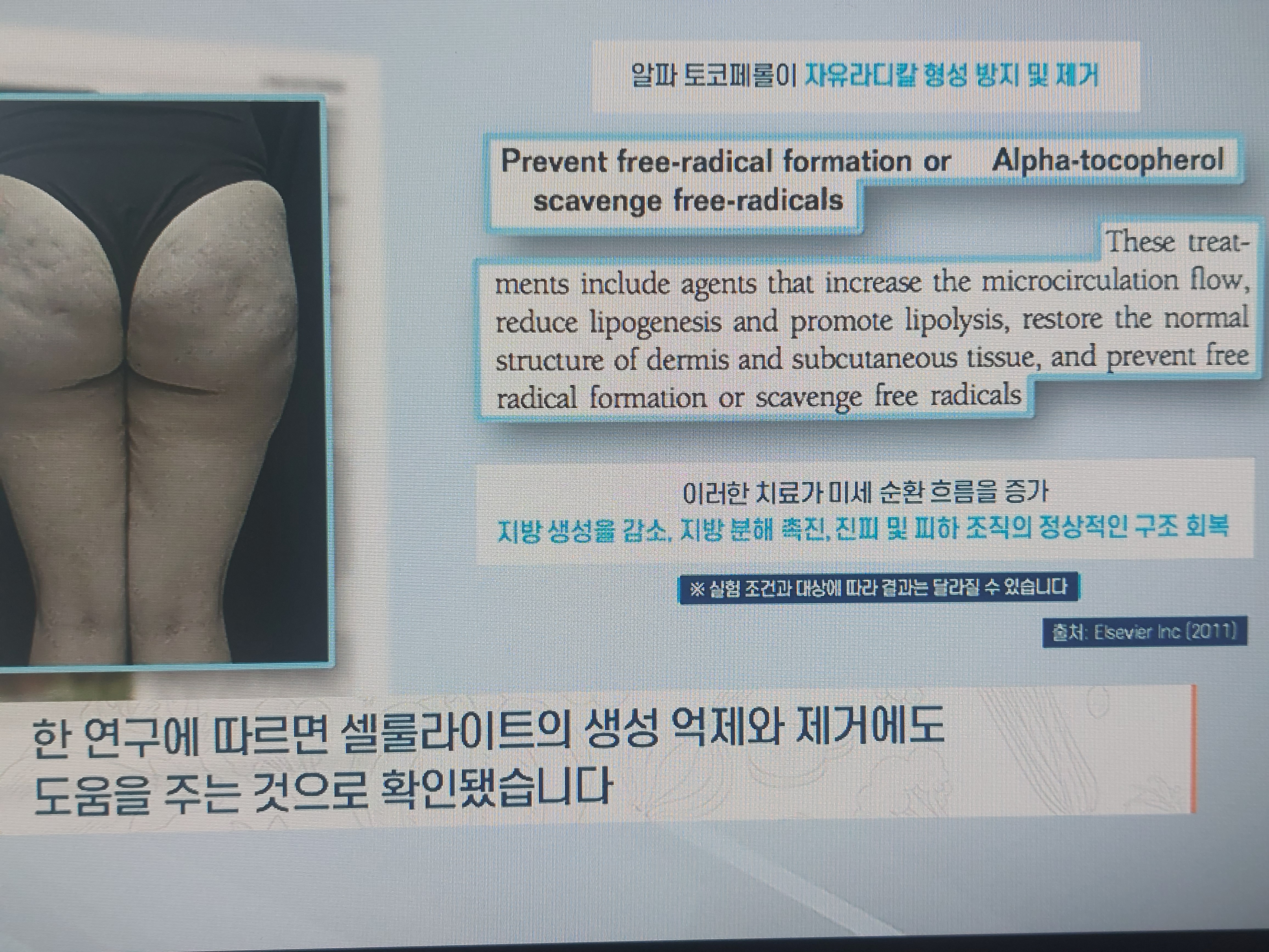 링곤베리 효능