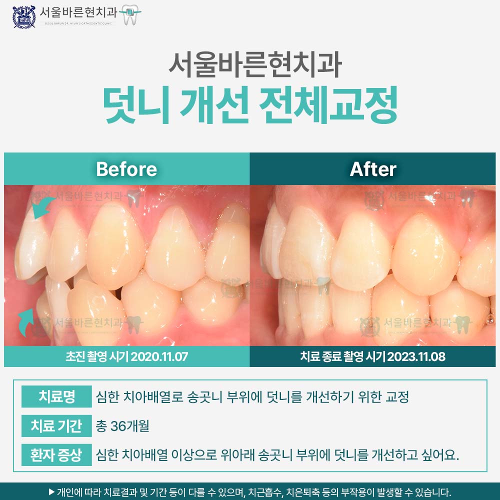 부산전체교정
