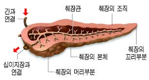 췌장암 의심 증상 여섯가지 발생원인 초기 의심 증상 검사방법 예방법