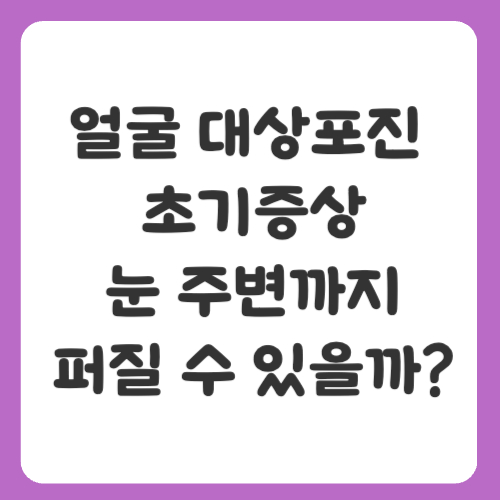 얼굴 대상포진 초기증상, 눈 주변까지 퍼질 수 있을까?