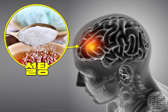 치매 걸리는 이유 습관 치매 생기는 이유 치매원인 설탕 탄수화물