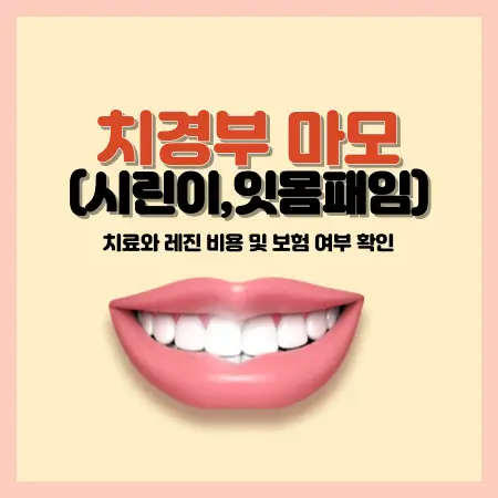 치경부-마모-시린-이-잇몸-패임-치료와-레진-비용-및-보험-여부-확인