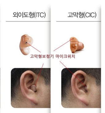히어닷컴 보청기 가격 및 종류 알아보기 (3)
