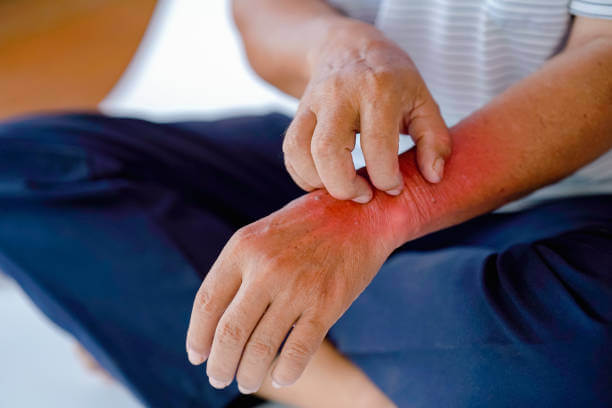 대상포진 초기증상 대표 6가지 및 통증&amp;#44; 치료방법에 대해 알아봤습니다. 대상포진이 걸리면 무엇보다 통증이 심해서 매우 힘들어하는데요~ 그래서 하루빨리 증상이 나타나면 병원에 가야 합니다! 증상을 확인해보세요~