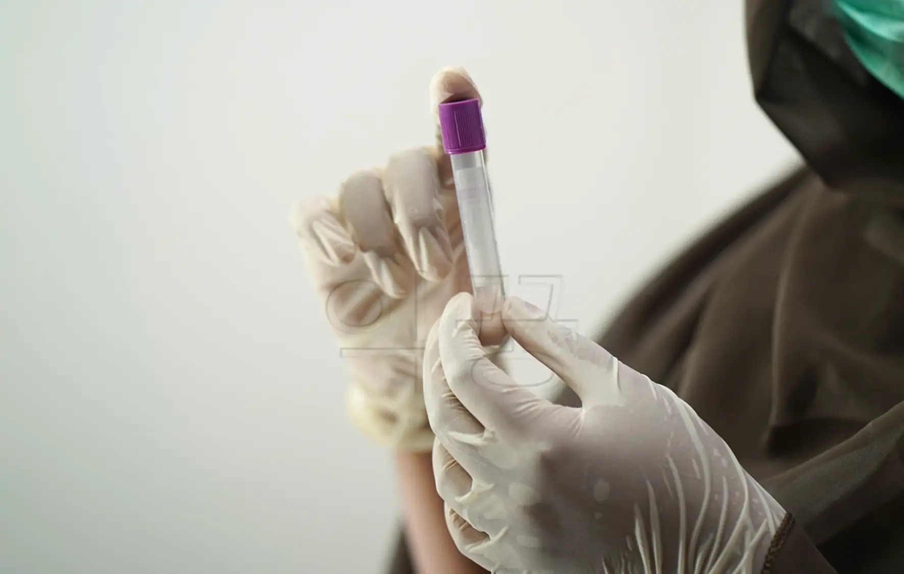 감마지티피 수치 정상범위 체크는 피검사로 한다