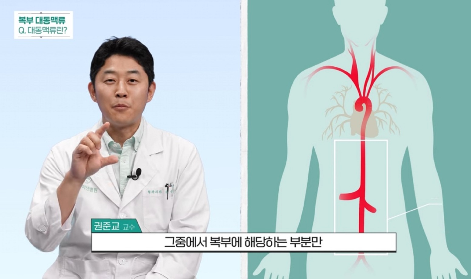 -복부대동맥-강진모-교수