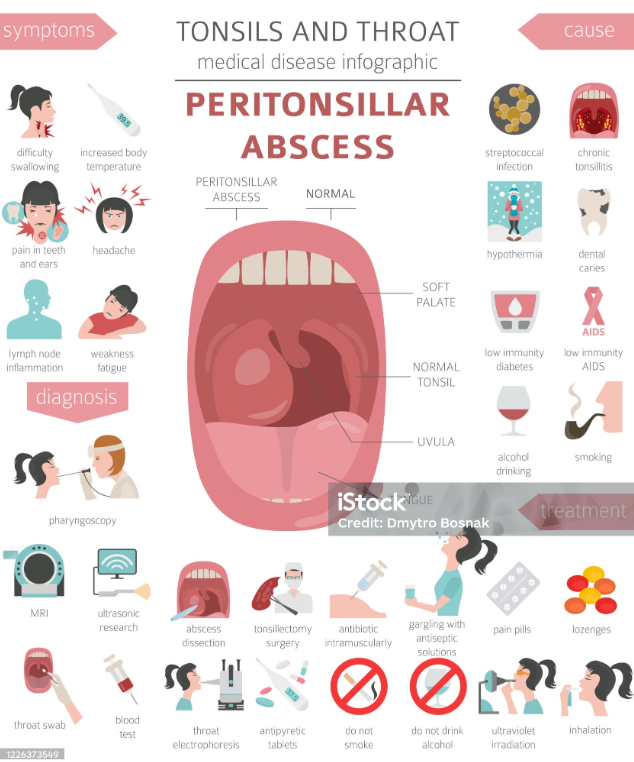 혀 통증의 원인과 치료