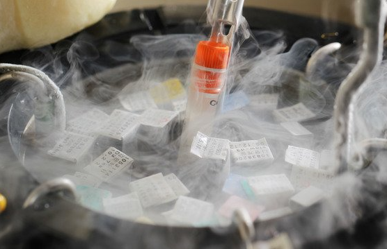 냉동 난자 보관 탱크 사진