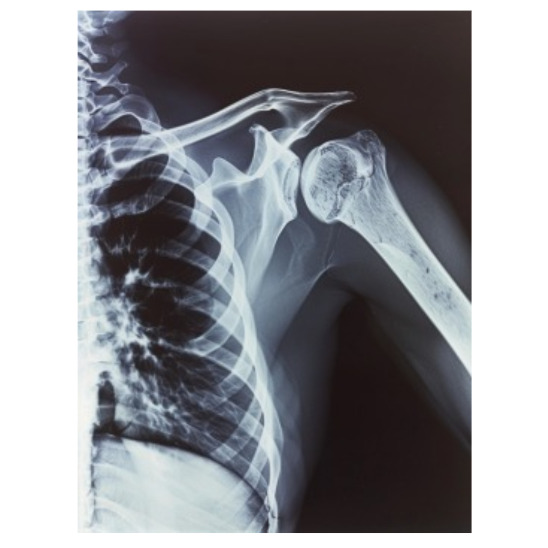 어깨통증과 관련된 사진입니다.