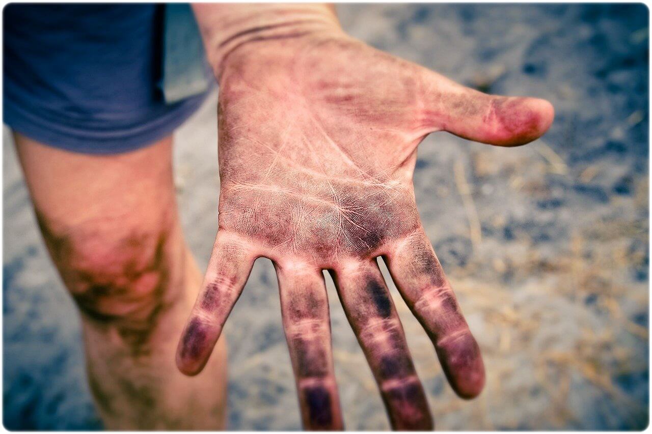 피부암 초기증상 원인 종류 진단 및 치료 방법 예방 방법