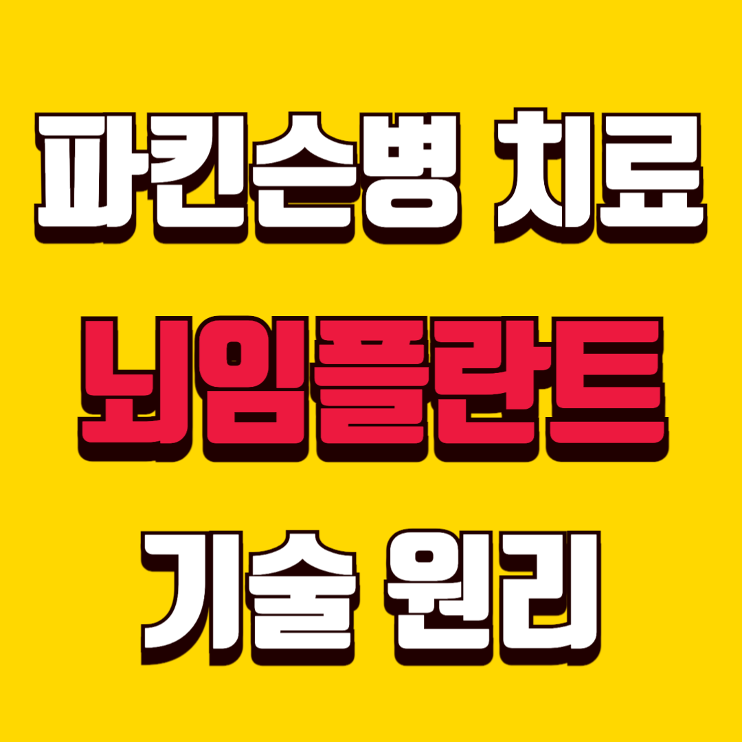 파킨슨병 치료의 미래, 뇌임플란트(BCI) 기술 원리와 최신 전망